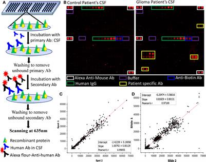 A Protein Microarray-Based Investigation of Cerebrospinal Fluid Reveals Distinct Autoantibody Signature in Low and High-Grade Gliomas